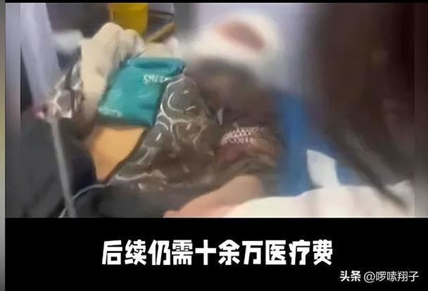 2025新澳门正版免费挂牌和7岁男孩遭3只犬撕咬与7岁男孩遭3只犬撕咬怎么办